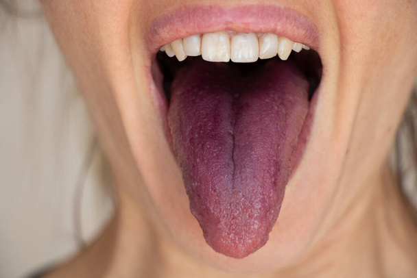 Κόκκινη γλώσσα μετά από μουριά, ανοιχτό στόμα και γλώσσα ενός κοριτσιού κοντινό πλάνο - Φωτογραφία, εικόνα