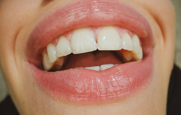 Smiling mouth. Dental care, healthy teeth and smile, white teeth in mouth. Closeup of smile with white healthy teeth - Photo, Image