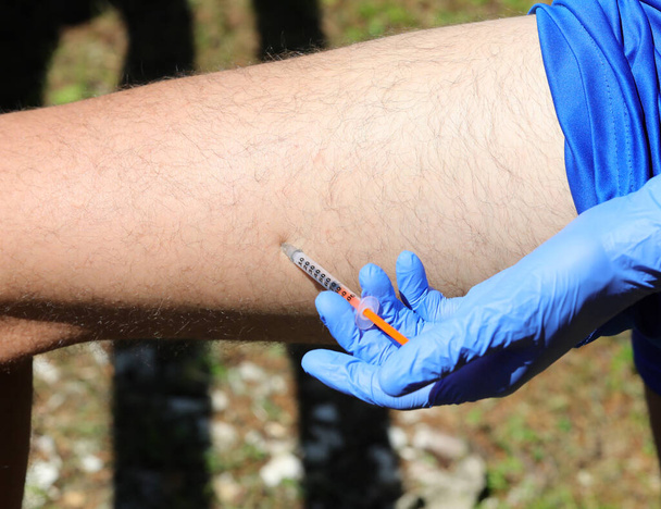 jeune garçon avec des gants bleus lors de l'injection d'insuline dose sur la cuisse de la jambe parce qu'il a le diabète - Photo, image