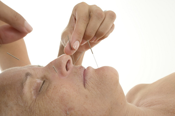Akupunktur bei Senioren - Foto, Bild