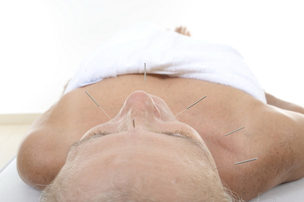 Akupunktur - Foto, Bild