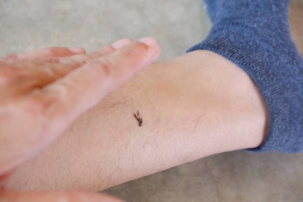 Aedes mosquito que fue golpeado hasta la muerte en la pierna. - Foto, imagen