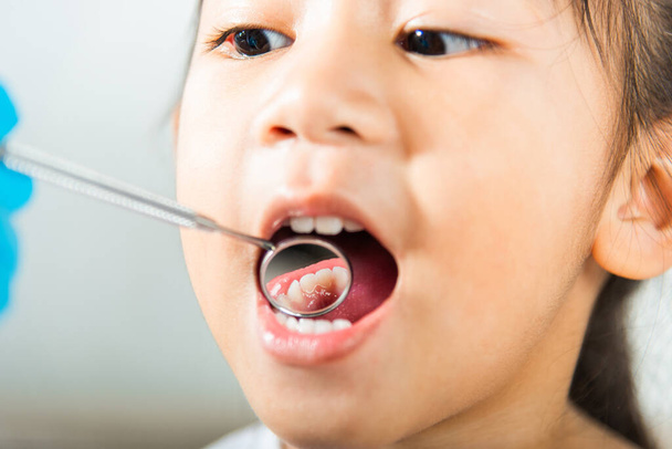 Dental kid health examination. Asian dentist making examination procedure for cute little girl open mouth, Doctor examines oral cavity of little child uses mouth mirror to checking teeth cavity - Photo, image