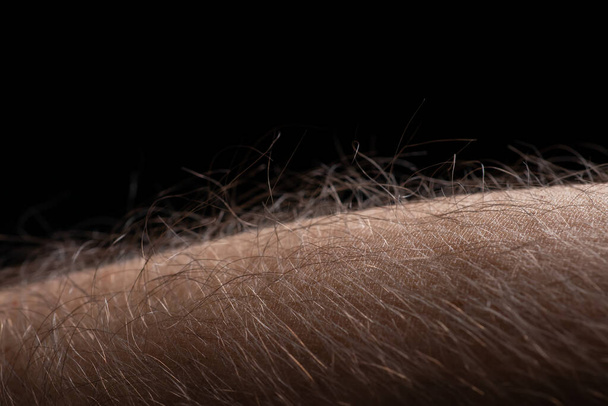 Human skin with hair on black background. Goose bumps. - Photo, Image