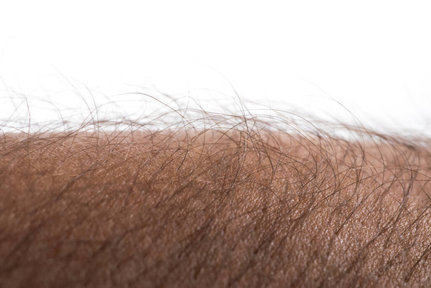 Human skin with hair on white background. Goose bumps. - 写真・画像
