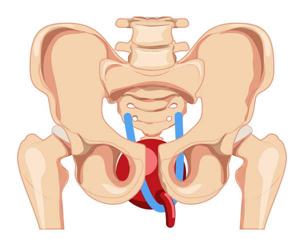 Urinary incontinence tension-free vaginal tape TVT female stress urinary incontinence therapy Female system Front view is skeleton pelvis. Human anatomy location scheme flat style icon isolated - ベクター画像