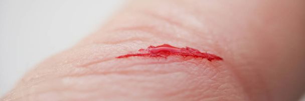 Nahaufnahme eines verletzten Fingers mit blutendem Blut auf offener Schnittwunde. Schnitt mit scharfem Messer. Schmerzen, Schmerzen, Schmerzen, medizinische Hilfe erforderlich, Wundkonzept - Foto, Bild