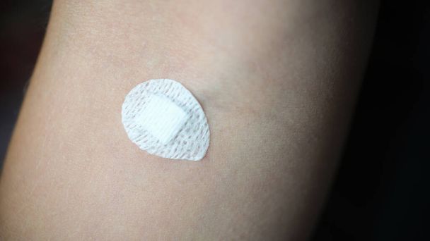 Small round patch stuck in place intravenous injection on forearm closeup. Medical laboratory blood tests concept - Foto, Imagen