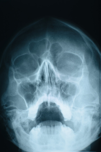 Kopf-Röntgen - Foto, Bild