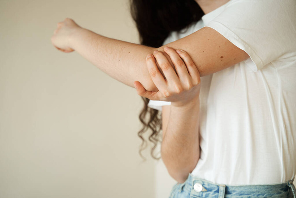 Dirsek yaralanması. Bir kaza sonucu kolunda ağrı ve çürük olan güzel bir kız. Travmatoloji - Fotoğraf, Görsel