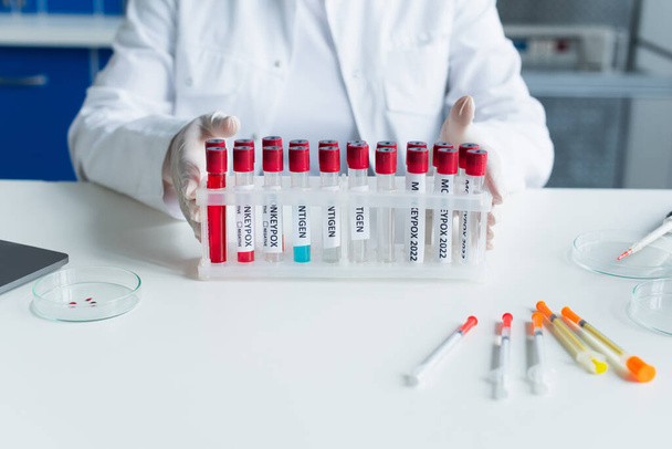 Cropped view of scientist holding test tubes with monkeypox lettering near syringes in lab  - Фото, изображение