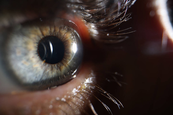 Лазер и молодая женщина крупным планом глаз. Посещение офтальмолога для коррекции зрения - Фото, изображение