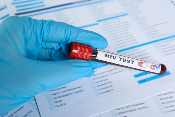Scientist holding tube with blood sample and label HIV Test against laboratory form, closeup - Foto, immagini