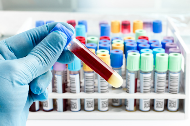 Laboratory technician holding a blood tube test - Photo, Image