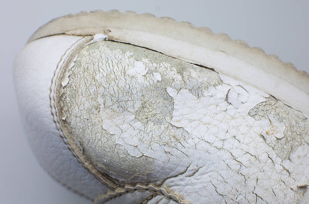 Close up Torn white leather sneakers. Leather shoes. Shoe repair concept. - Photo, Image
