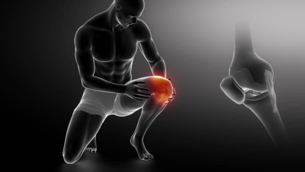 Pain in knee concept - Footage, Video