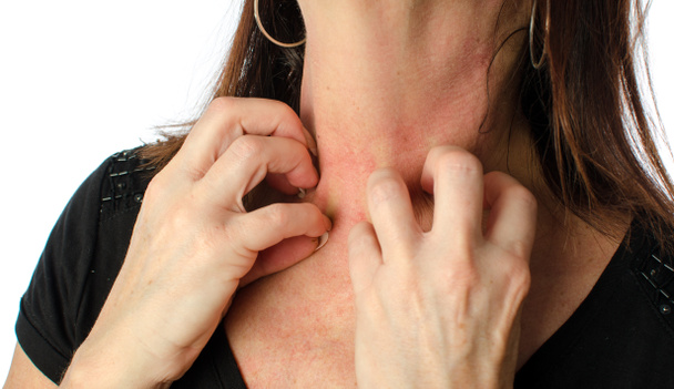 Woman scratching her neck - Photo, Image
