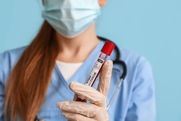 Doctor with sample of monkeypox virus on blue background, closeup - Фото, зображення