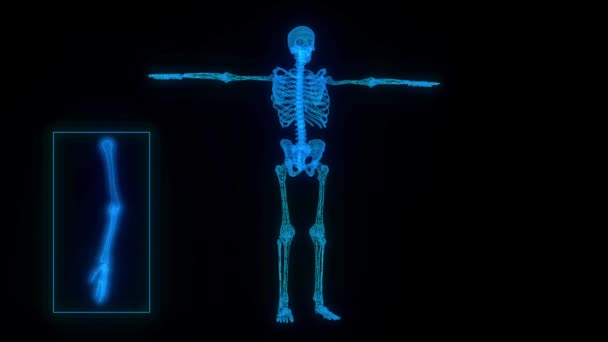 Images vidéo numériquement améliorées d'un squelette humain scanné par rayons X. - Séquence, vidéo
