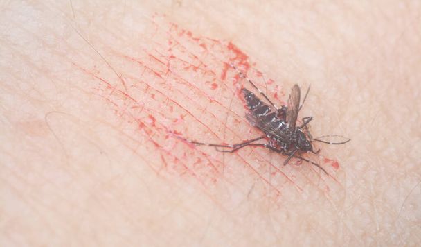 colpo ravvicinato della zanzara uccisa sulla pelle dell'uomo. - Foto, immagini