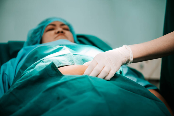 Doctor using a hand to hold the belly fat Of obese woman patients, who received treatment for abdominal fat reduction surgery from obesity, to people health care and surgery concept. - Foto, Bild