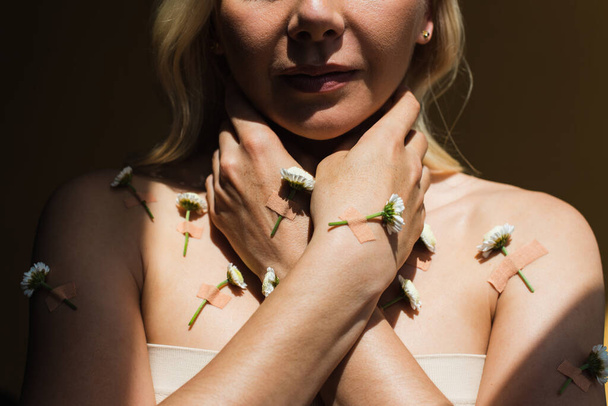 cropped view of woman with with plasters and white flowers on body isolated on black  - Fotó, kép