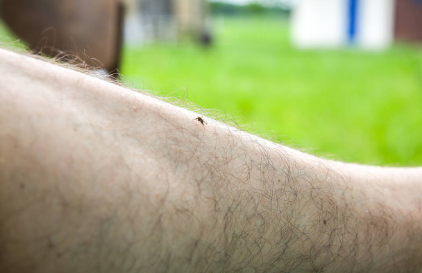 Bacağının üzerinde oturan sivrisinek. Böcekler yazın ısırır. Tehlikeli bir doğa. Kaşındıran vücut. - Fotoğraf, Görsel