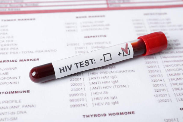 Tube with blood sample and label HIV TEST on laboratory form, closeup - Φωτογραφία, εικόνα
