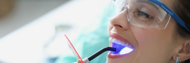 Портрет женщины в стоматологическом кабинете, получающей процедуру отбеливания, широко раскрытый рот. Стоматолог обеспечивает полный уход за зубами пациента. Концепция здоровья - Фото, изображение