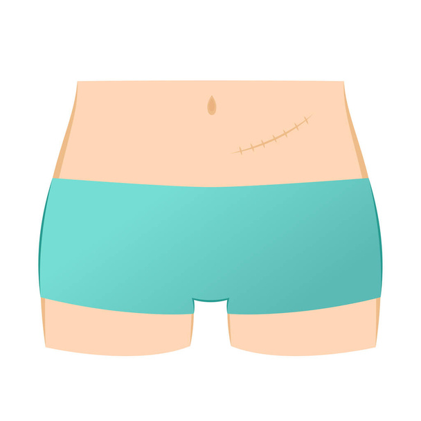 Suture cartoon vector. body vector. free space for text. wallpaper. background. Cough. - Vector, Image