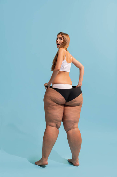 Collage with beautiful thin girl with body of plus-size woman with cellulite skin isolated on colorful background. Beauty, fashion, weight loss, healthy eating, motivation concept. Poster for ad - Foto, Imagen