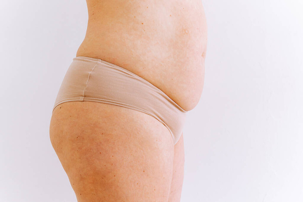 Saggy stretched belly, sagging skin with age spots on fat belly, plastic surgery concept. figure of unrecognizable woman in profile, with fat belly hanging over bikini - Valokuva, kuva
