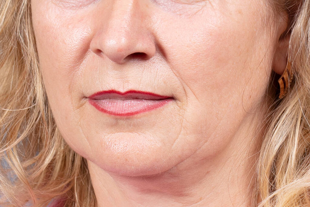 The lower part of the face and neck of an elderly woman with signs of skin aging. Age-related changes, flabby sagging skin of the face. Cosmetology and beauty concept - Foto, imagen