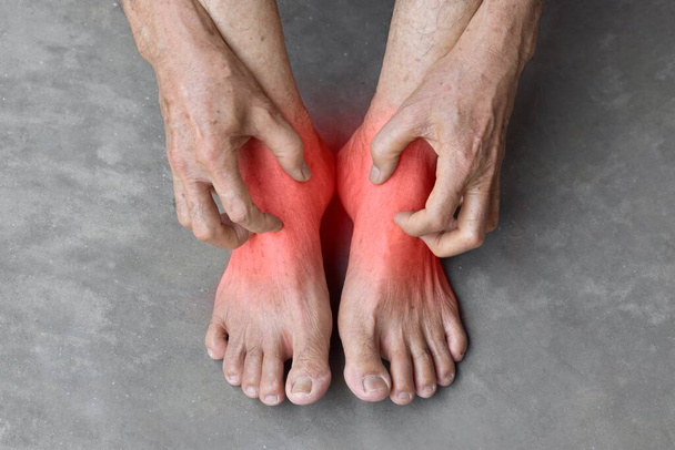 Asian elder man scratching his foot. Concept of itchy skin diseases such as scabies, fungal infection, eczema, psoriasis, allergy, etc. - Foto, immagini