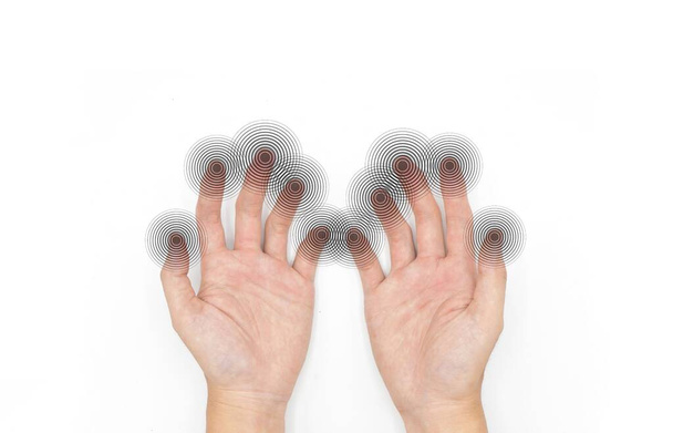 Hormigueo y entumecimiento en las yemas de los dedos de un joven asiático con diabetes. Problemas de sensación en los dedos. Problemas de manos y nervios. Tacto fino - Foto, imagen