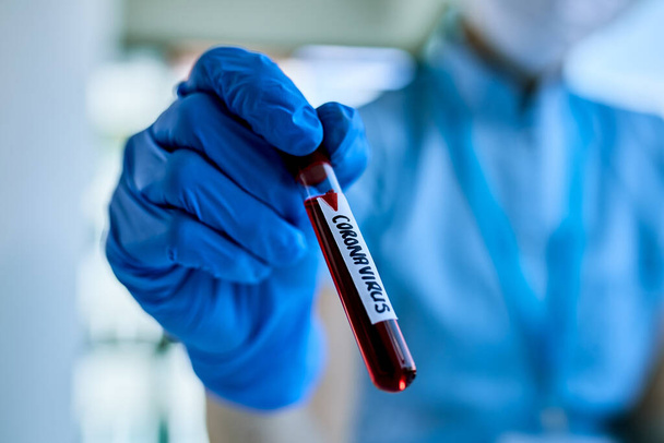Close-up of epidemiologist with coronavirus blood sample in specimen holder. - Foto, afbeelding