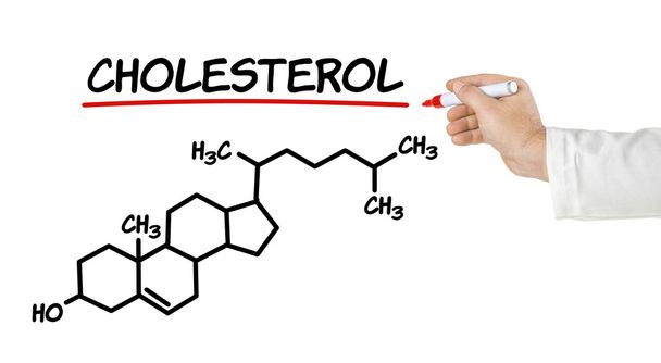 Fórmula química del colesterol sobre un fondo blanco
 - Foto, Imagen