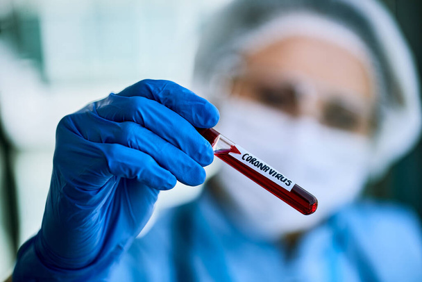 Close-up of doctor holding blood sample infected with corona virus. - Photo, image
