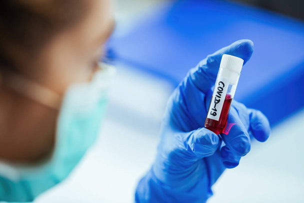 Close-up of laboratory technician with coronavirus blood test sample.  - 写真・画像