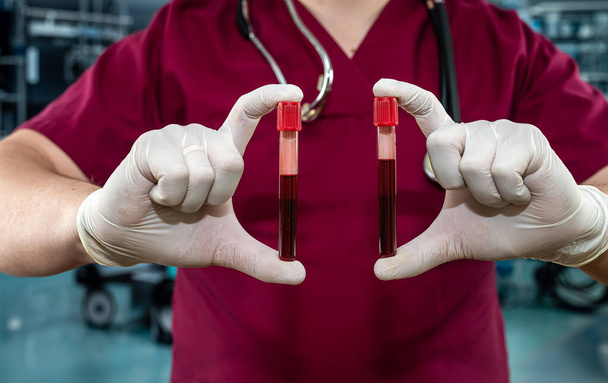 Γιατρός με κόκκινη στολή που κρατάει αίμα σε δοκιμαστικό σωλήνα για τον ιό του στομίου στο εργαστηριακό νοσοκομείο.. - Φωτογραφία, εικόνα