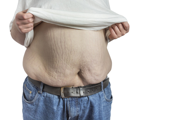 hombre con sobrepeso en jeans azules levantando camisa blanca
 - Foto, Imagen