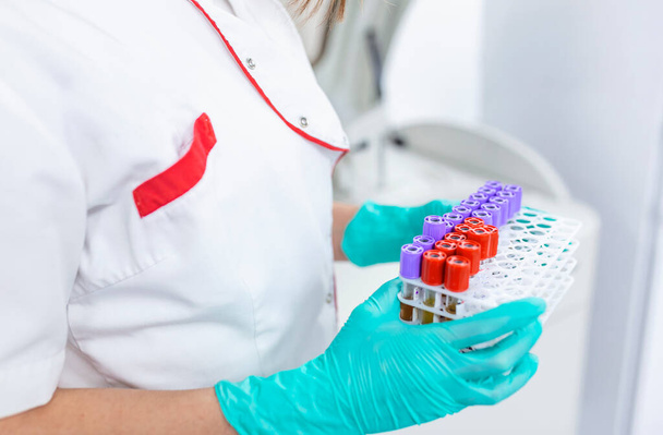 Hand eines Labortechnikers mit Blutröhrchen-Test und Hintergrund eines Gestells mit Farbröhrchen mit Blutproben anderer Patienten / Labortechniker mit Blutröhrchen-Test - Foto, Bild