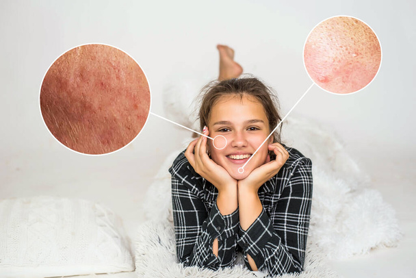 Cute teenage girl have fun on bed with feathers. Image of young smiling pretty lady lies in bed indoors. inserts with infectious skin diseases - Foto, immagini