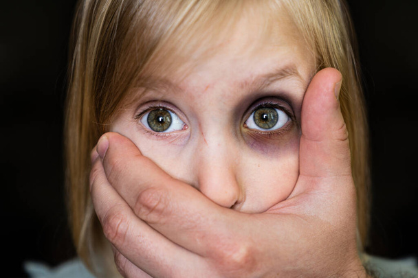 child abuse, violence concept - scared young girl, mouth closed with adult hand, black eye. High quality photo - Photo, Image