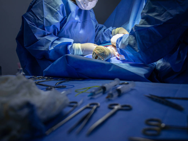 surgical center in procedure fistula for dialysis focus selective and defocused - Foto, immagini