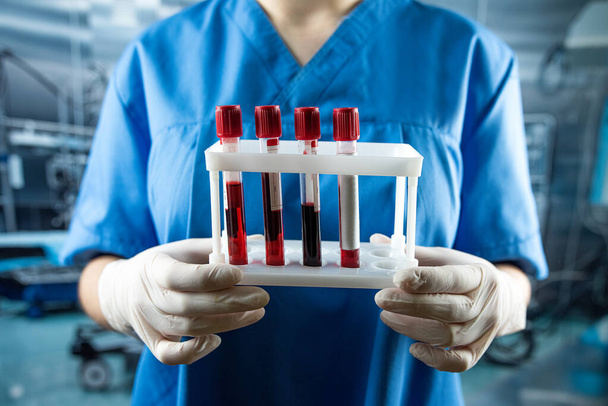 nurse in hospital holding blood in test tubes for analysis. Work at clinical laboratory - Foto, Imagen