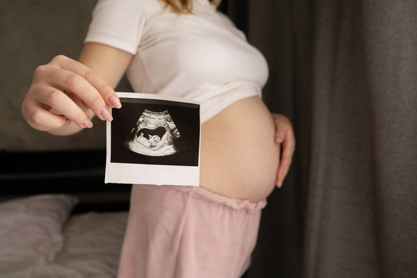 Pregnant woman demonstrating her ultrasound photo while standing at bedroom. Picture with ultrasound scan result in focus. - Photo, Image