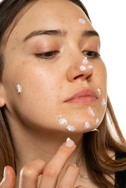 Woman applying acne cream on her face for solving acne inflammation on her face on a white background - 写真・画像