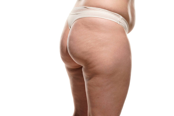 Side view of overweight woman with fat cellulite legs, belly and buttocks, obesity female body, white background. - Photo, Image