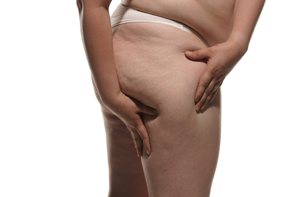 Overweight woman showing fat cellulite legs and buttocks, obesity female body isolated on white background. - 写真・画像